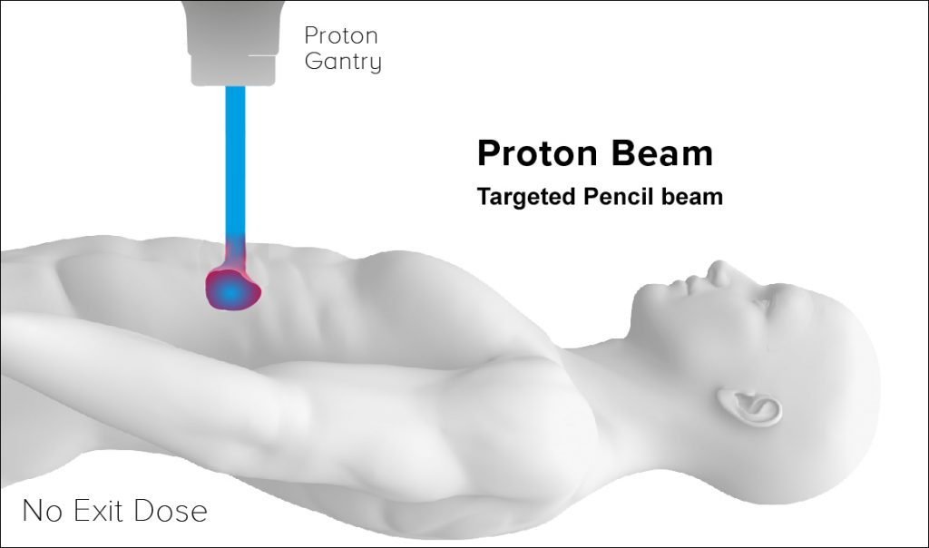 Proton beam illustration